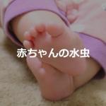 【赤ちゃんの水虫】赤ちゃんの手足にできる水疱は水虫の可能性が高い